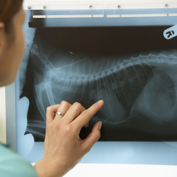 a person pointing at an x-ray